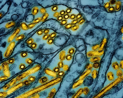 Les particules de virus H5N1 de la grippe aviaire (jaune) cultivées dans des cellules rénales canines (bleues).