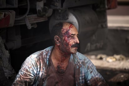 Un travailleur blessé après l'explosion du port de Bandar Abbas ce samedi