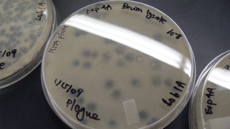 Les microbes du sol éliminent 70 millions de tonnes d&rsquo;hydrogène de l&rsquo;air chaque année : des scientifiques australiens isolent l&rsquo;enzyme Huc et la transforment en une batterie qui ne nécessite jamais d&rsquo;être branchée